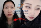 Une seule photo a transformé la compassion en colère ! | صورة واحدة قلبت التعاطف إلى غضب!